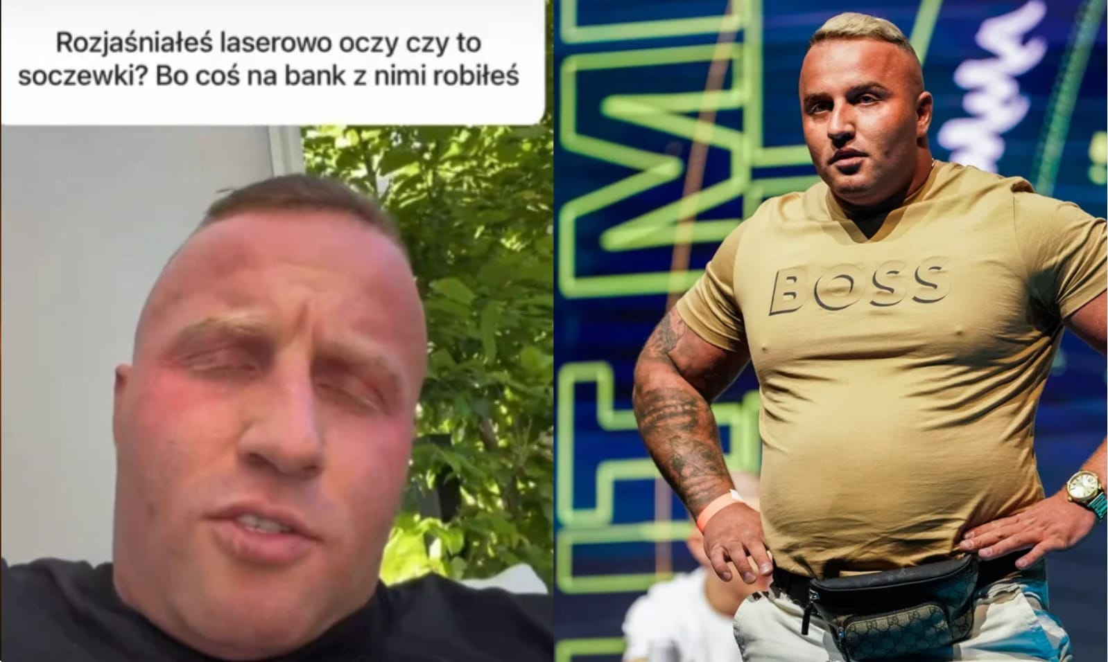 To są moje oczy, stać mnie było, to sobie zrobiłem. Denis Załęcki o laserowym rozjaśnieniu oczu Zdjęcie główne wpisu