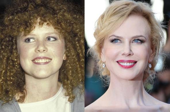 Nicole Kidman