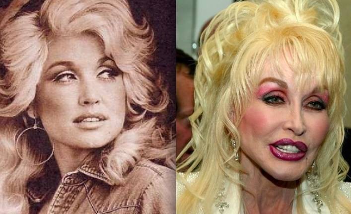 Dolly Parton