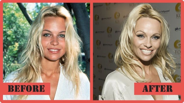 Pamela Anderson