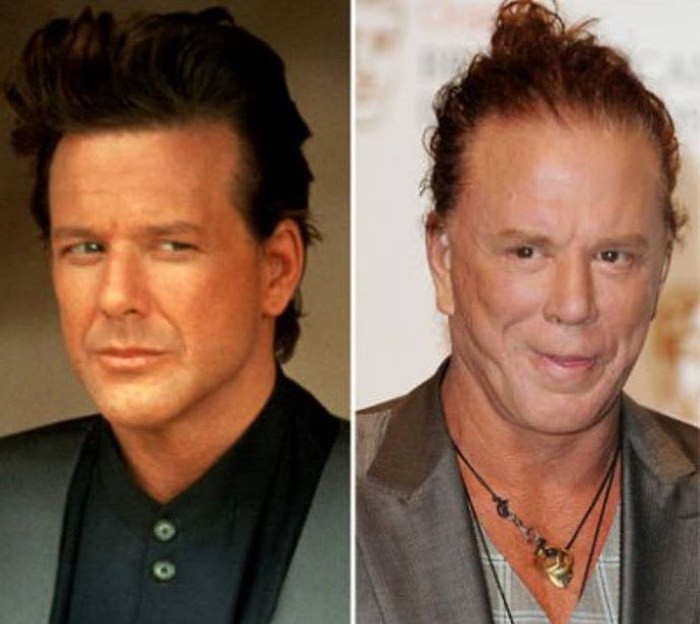 Mickey Rourke