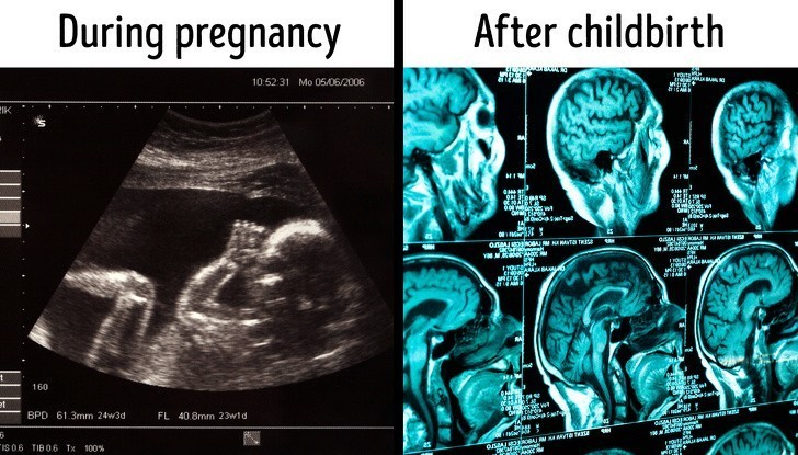 5. Więź z dzieckiem formuje się na płaszczyźnie fizycznej