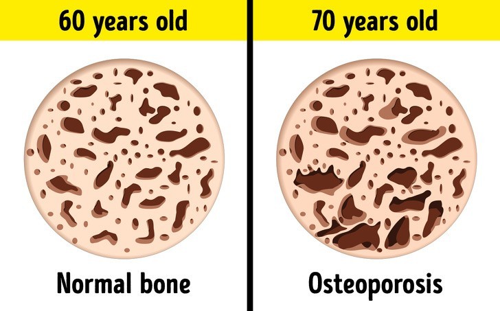 5. Od 60 do 70