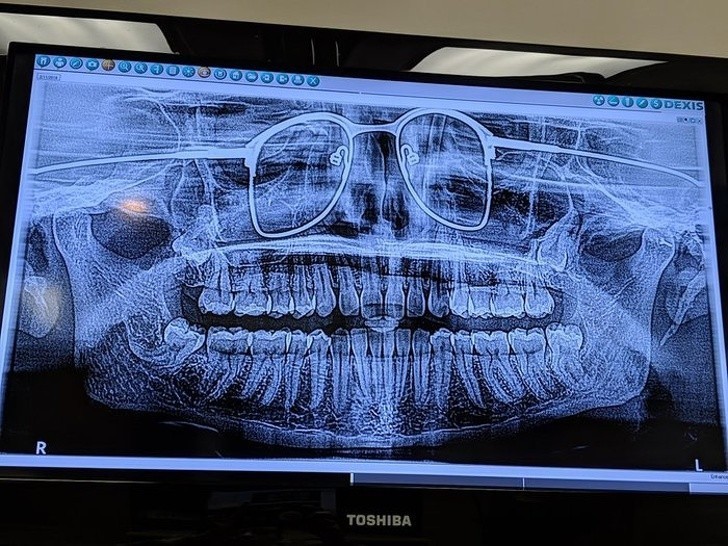 Zdjęcie panoramiczne szczęki. Pacjent zapomniał zdjąć okulary