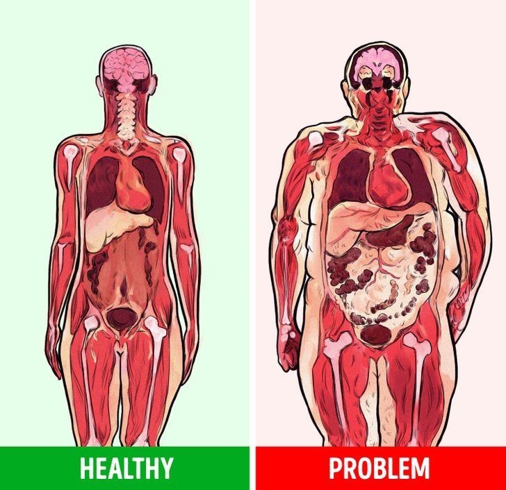 Większe ryzyko rozwinięcia zespołu metabolicznego