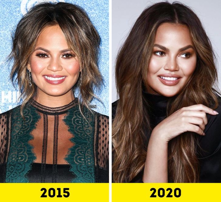 Chrissy Teigen