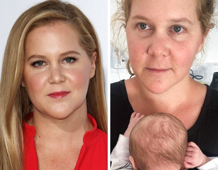 3. Amy Schumer