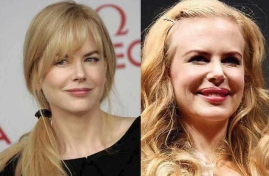 9. Nicole Kidman