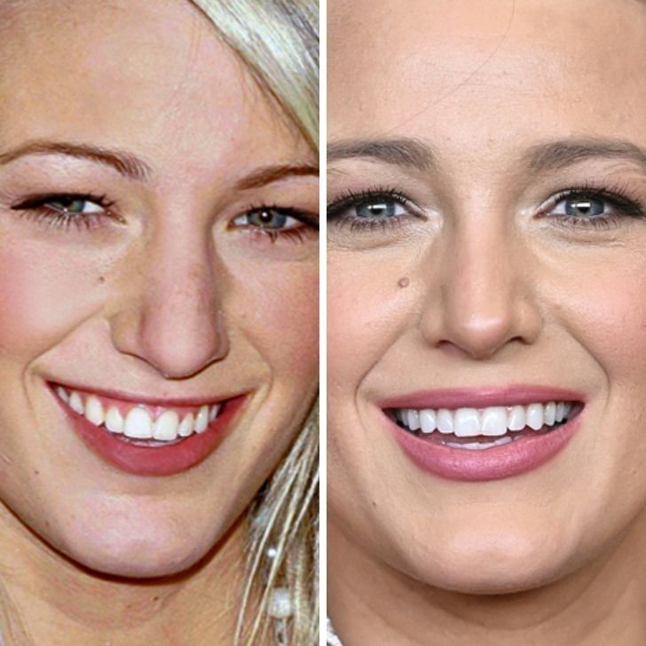 Blake Lively - 17 lat vs 32 lata