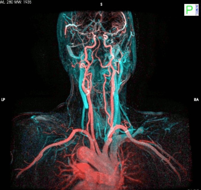 8. Żyły i arterie