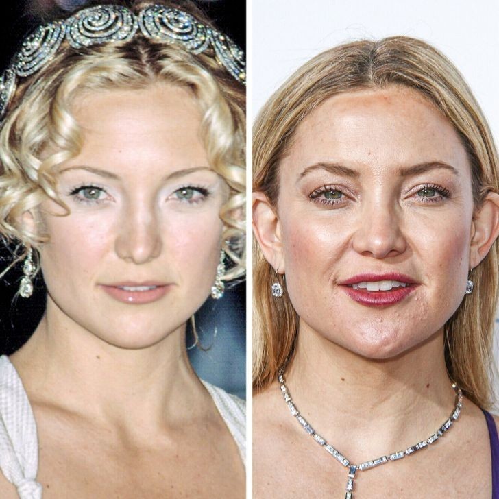 12. Kate Hudson