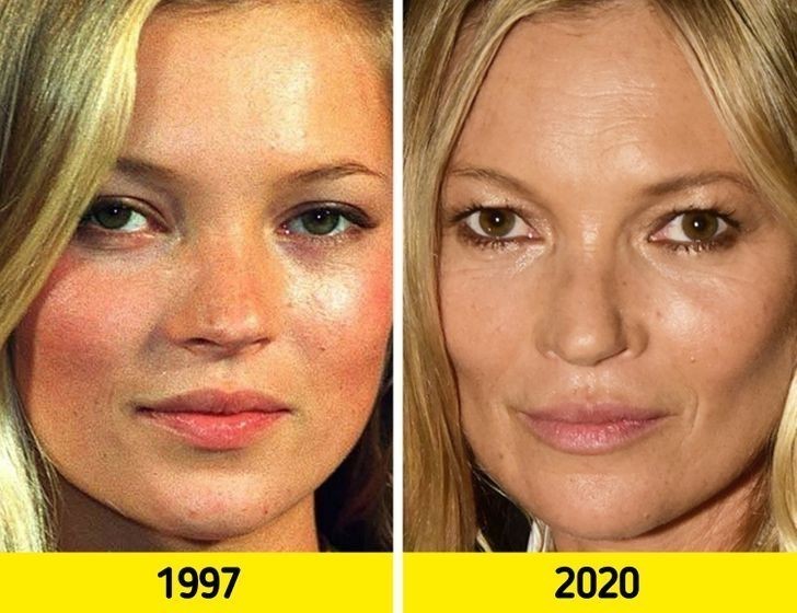 1. Kate Moss