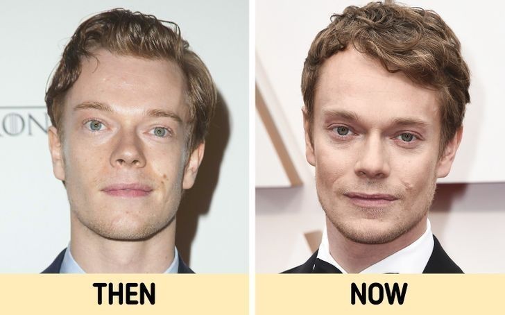 10. Alfie Allen