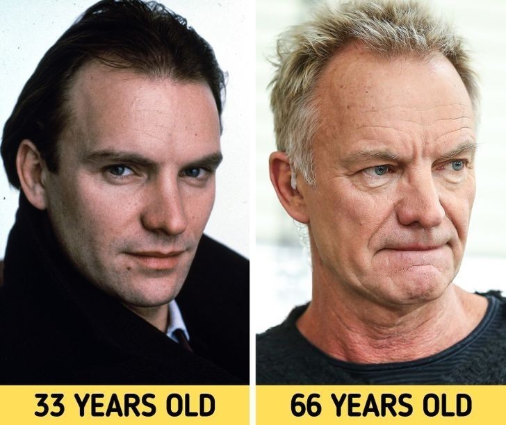 8. Sting