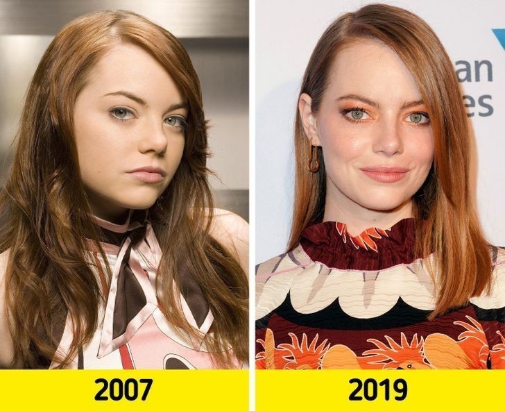 Emma Stone