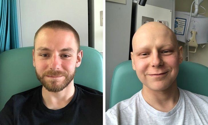 3 miesiące chemioterapii