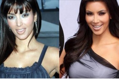 11 celebrytów przed i po ingerencji chirurgów plastycznych. Zobacz jak można kupić piękno!