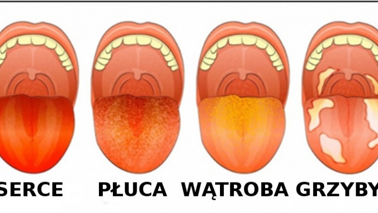 13 rzeczy które kolor Twojego języka może powiedzieć o Twoim zdrowiu! Obejrzyj go dokładnie w lustrze! 