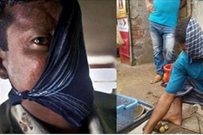 20 lat temu tygrys okaleczył mu twarz! Mężczyzna w końcu zdecydował się pokazać jak cierpi! 