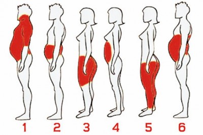 6 typów otyłości - poznaj różnice oraz dowiedz się jak z nimi walczyć! Precyzyjne działania dają  skutki!