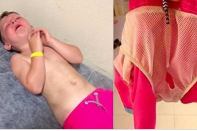 Chłopiec bawiący się w basenie zaczyna krzyczeć! Mama jest przerażona gdy zdejmuje mu kąpielówki!