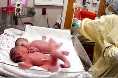 Dopiero się urodziły i nie przestają płakać! Lekarz kładzie te bliźniaki obok siebie i robią coś niezwykłego!