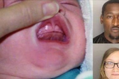 Dziecko w złym stanie trafia na odział! Rodzice zostali aresztowani gdy policja zajrzała do ust chłopca!