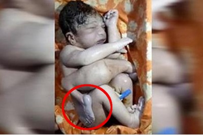 Gdy matka widzi dziecko jakie urodziła chce utopić je w rzece! Pomoc przychodzi w ostatnim momencie! 