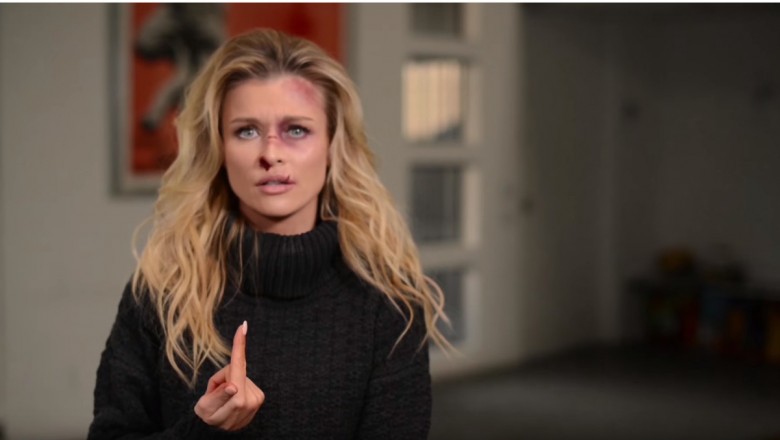 Joanna Krupa cała w siniakach! Mocna kampania przeciwko przemocy wobec zwierząt!