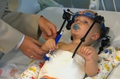 Lekarze uratowali dziecko które przeżyło wewnętrzna dekapitację! Cud medycyny! 