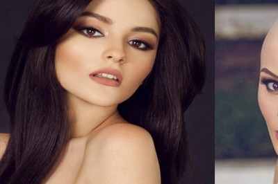 Miała zostać modelką ale chemioterapia pozbawiła ją włosów! Odważyła się na niesamowitą sesję zdjęciową!