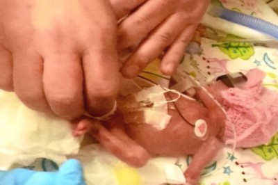 Musiałą wybrać aborcję lub poród w 24 tygodniu! 9 miesięcy później lekarze nie poznają jej dziecka! 