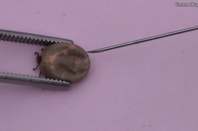 O matko jakie obrzydliwe! Czyli co się stanie z kleszczem, gdy wstrzykniemy mu wodę utlenioną!