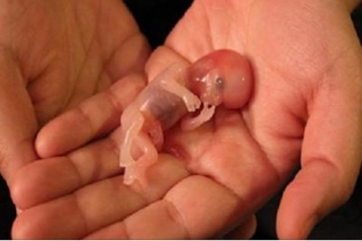 Pielęgniarka wyznaje co tak naprawdę dzieje się z dziećmi które przeżyły aborcję! Mocne słowa!