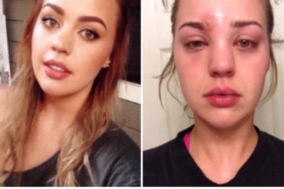 Podczas robienia makijażu zauważyła zgrubienie na brwi! Po kilku godzinach zaczęły się dziwne objawy!