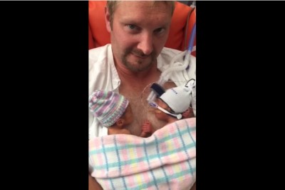 Tata trzyma na piersiach przedwcześnie urodzone bliźniaki! Teraz przyjrzyj się rączkom braci! 