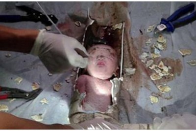 Ukrywała, że jest w ciąży i noworodka próbowała spuścić w toalecie! Zobacz niezwykłą akcje ratunkową! 