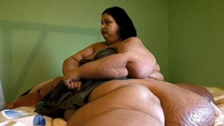 Ważyła 453 kg i była oskarżona o morderstwo! Nie uwierzysz jak wygląda po kilku operacjach i diecie!