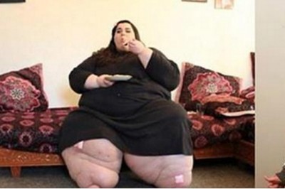 Ważąc 300 kg przechodzi operacje zmniejszenia żołądka! Gdy lekarz zobaczył ją po roku nie poznał jej! 