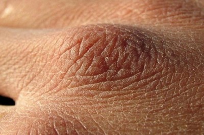 Wydaje CI się, że pijesz za mało płynów? Poznaj 8 oznak, że pijesz za mało wody i Twoje ciało wysycha!