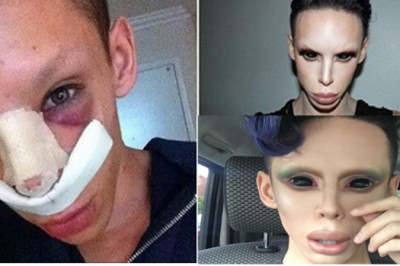 Wydał ponad 200 000 tyś żeby upodobnić się do kosmity! Zobacz jak wygląda człowiek bez płci!