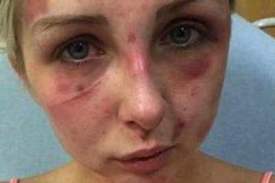 Zamknął dziewczynę w pokoju i przez 4 godziny ją katował! Spotkała go zbyt łagodna kara? 