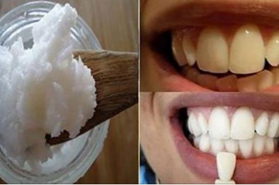 Zapomnij o kamieniu i  nieświeżym oddechu z ust! Płukanie ust tym jednym produktem pomaga! 