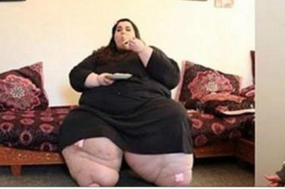 Kiedy ważyła 300 kg przeszła operacje zmniejszenia żołądka! Po roku lekarze nie mogli jej poznać!