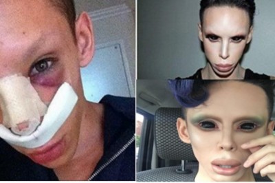 Wydał ponad 200 000 tyś zł żeby zostać człowiekiem bez płci! Chciał upodobnić się do kosmity!!