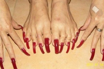 12 zdjęć paznokci u stóp, na widok których dostaniesz dreszczy! Patrząc na 4 nie będziesz mogła uwierzyć!