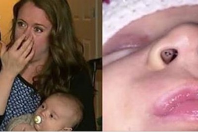 Karmiła piersią dziecko kiedy zauważyła w jego nosie czarne punkciki! Po chwili połączyła fakty!