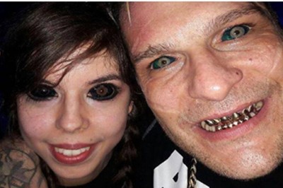 Nastolatka z Wrocławia chciała mieć oczy jak jej idol! Straciła wzrok w jednym oku !