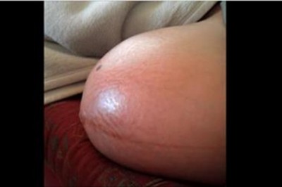 Dokłądnie widać jak kopią i się wiercą! Bliźniaki walczą o miejsce w brzuchu ciężarnej mamy!