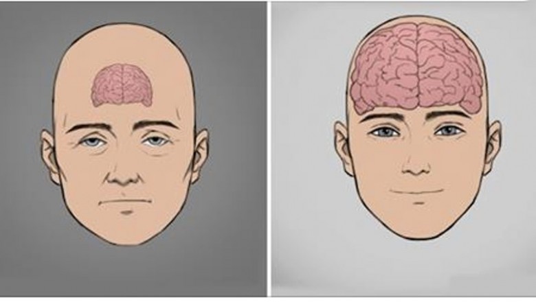 8 porad od neurologów które pomogą Ci zachować dobry nastrój i osiągnąć szczęście! Naucz się tego!